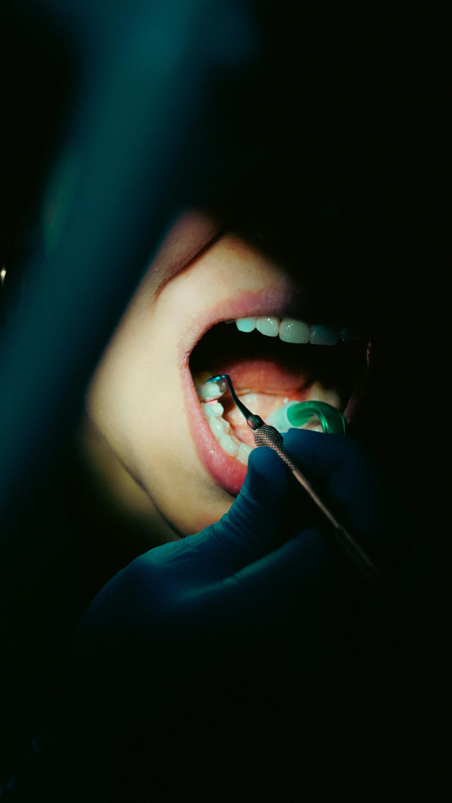 Procedimento odontológico em andamento.